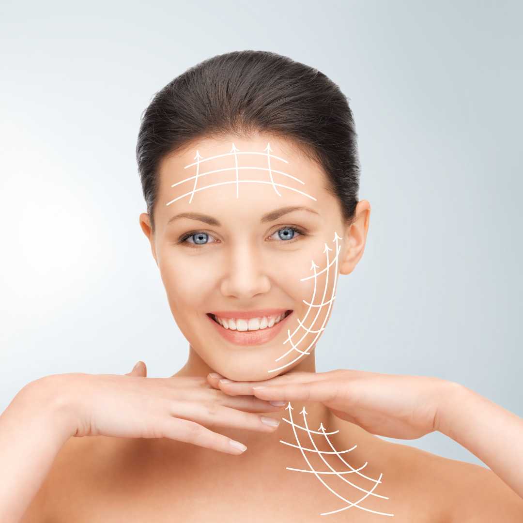 Facelift Package in Bangkok, Thailand by Dr. Siripong Plastic Surgery