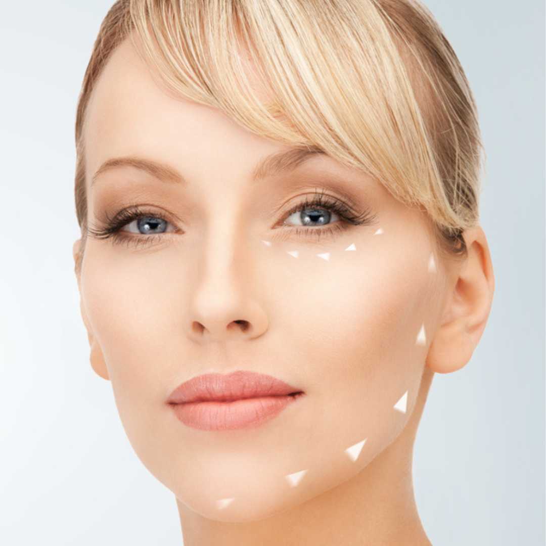 Facelift Package by Asia Cosmetic Hospital in Bangkok, Thailand
