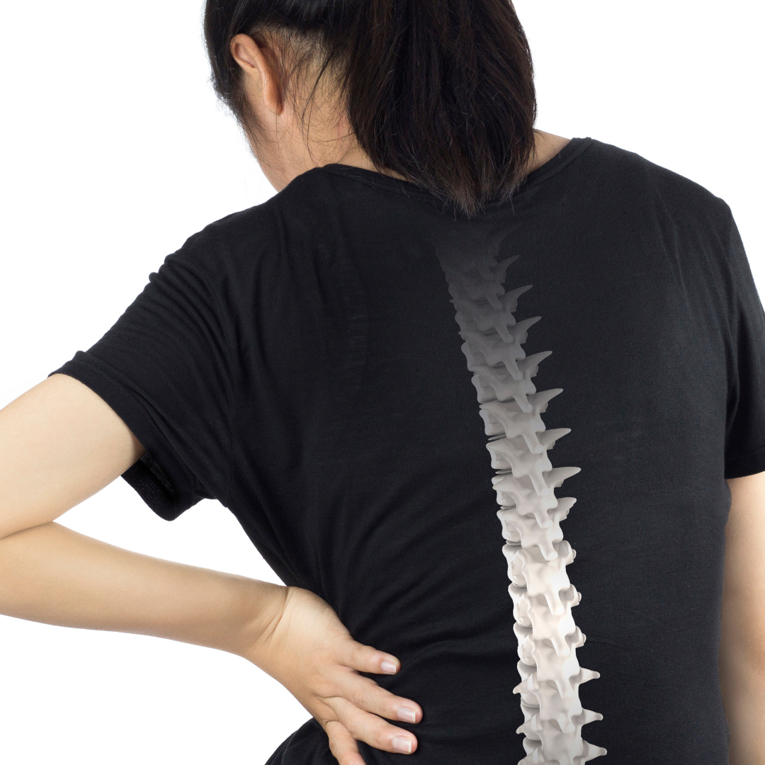 Spine Arthritis Stem Cell Package in Guadalajara Mexico