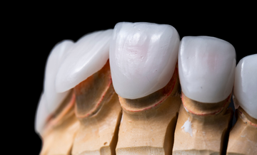 Dental Bridges Treatment Abroad