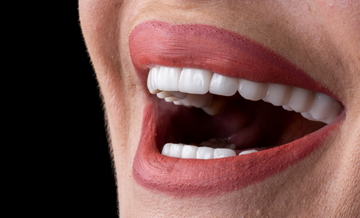 Dental Bonding Treatment Abroad